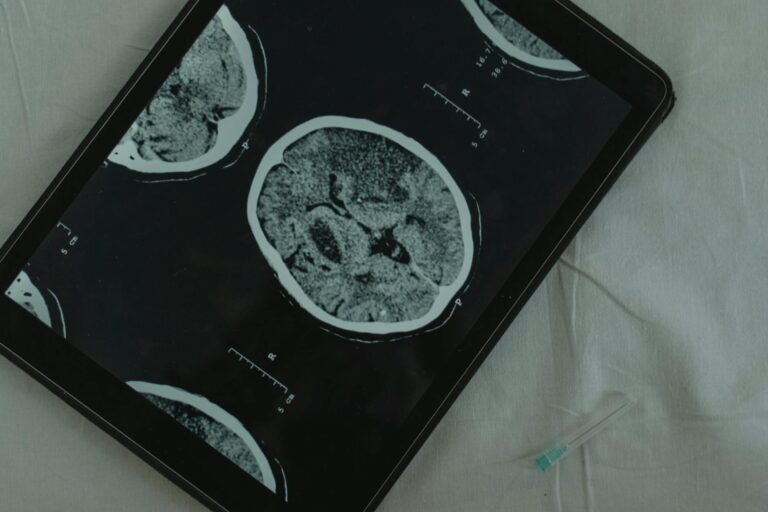 Alzheimer 2026: noile medicamente incetinesc boala, dar beneficiile sunt mai mici decat se spera — raport Cochrane