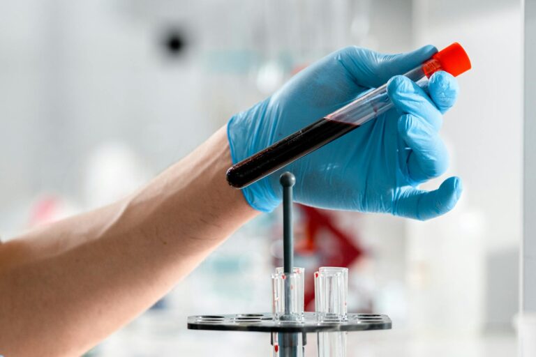 Test de sange MethylScan detecteaza 50 de tipuri de cancer inainte de simptome — cercetare UCLA 2026
