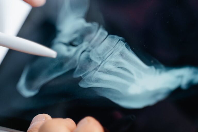 Osteoporoza: boala tăcută care fragilizează oasele — cum o previi și cum o tratezi