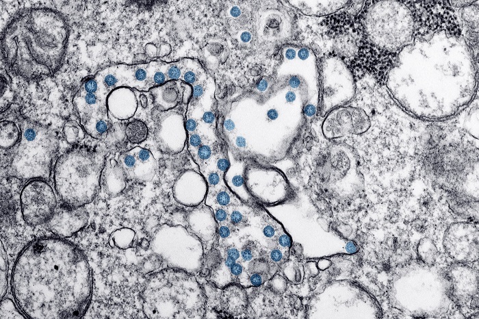 Infecția despre care multe femei însărcinate nu au auzit niciodată: citomegalovirusul